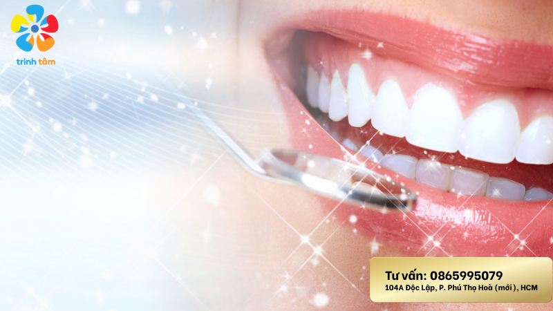 Cạo Vôi Răng – Vôi Răng Có Tự Tróc Được Không?