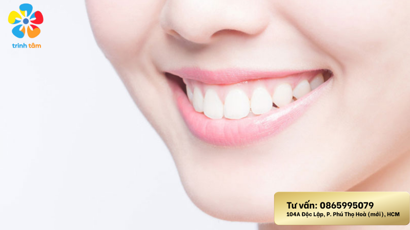 răng sâu hàm dưới