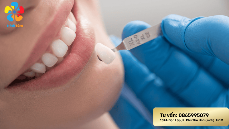 Bọc răng sứ – thời điểm vàng khi nào?