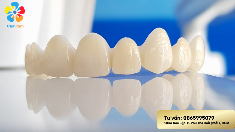 Phục hình răng sứ