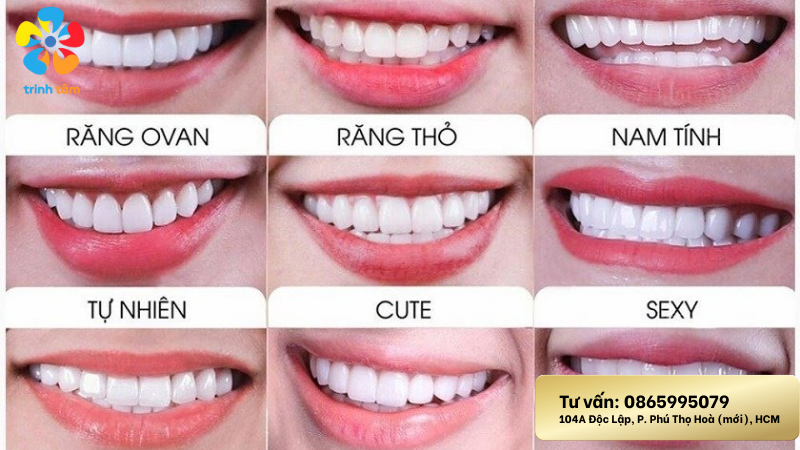 làm răng sứ