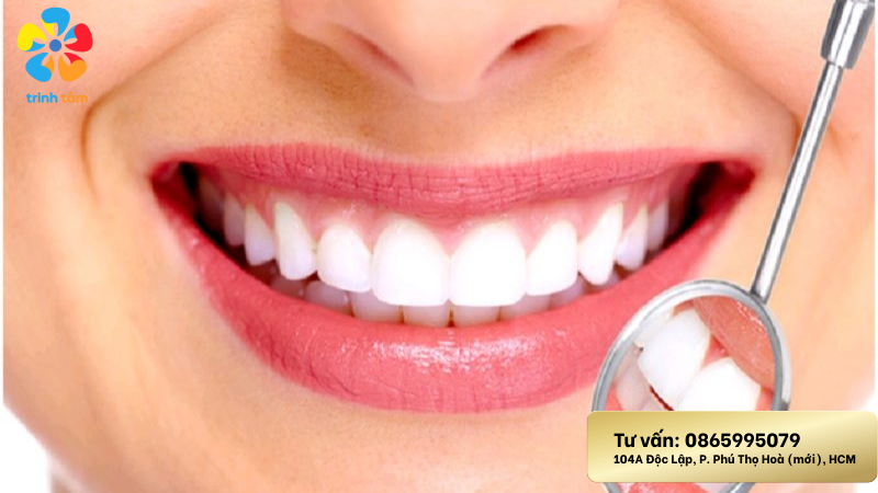 thẩm mỹ răng sứ