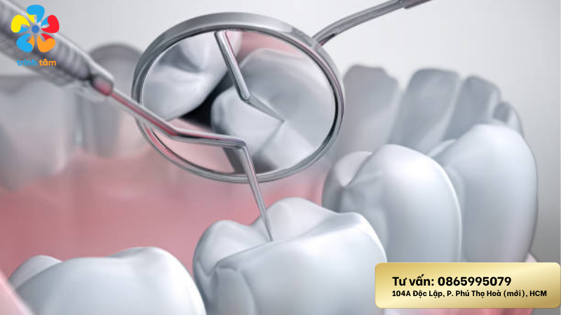 Chữa Sâu Răng Hiệu Quả Tại Nha Khoa Trinh Tâm