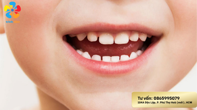 khám răng định kỳ cho trẻ