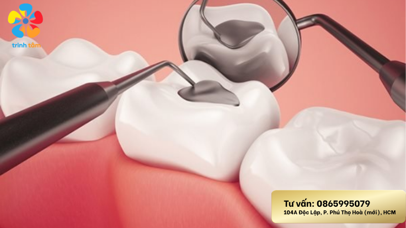 sâu răng ở trẻ