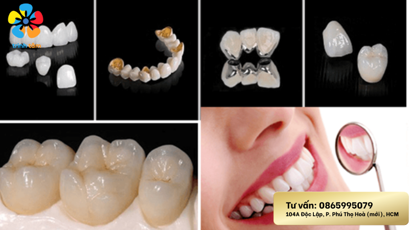 Bọc răng sứ 