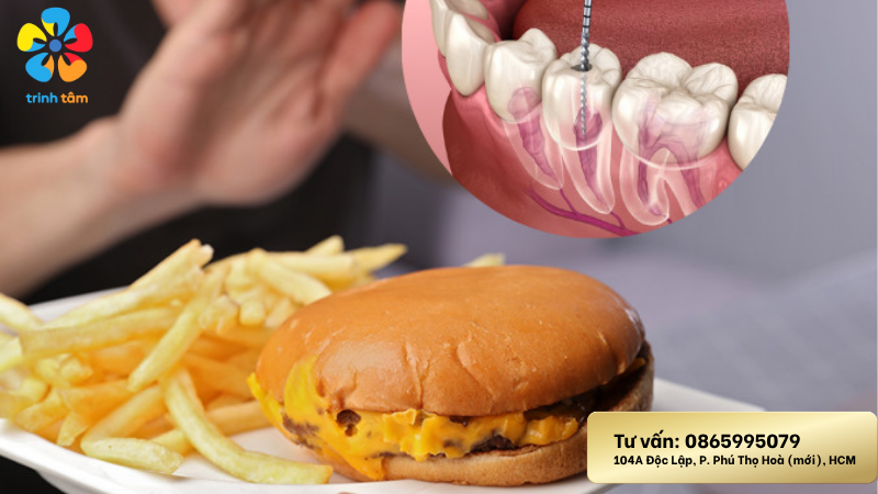 Lấy tủy răng nên kiêng ăn gì| Lấy tủy răng giá rẻ