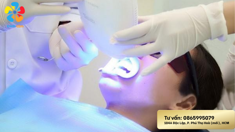 Tẩy trắng răng bị vàng nên làm gì|Tẩy trắng răng giá rẻ