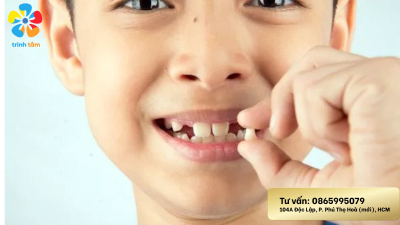 nhổ răng sữa cho trẻ