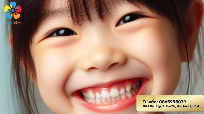 Nhổ răng sữa cho bé