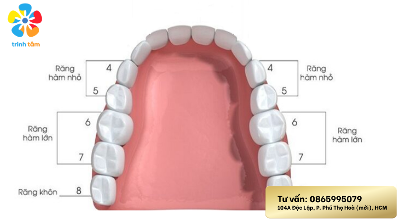 trẻ bị sâu răng hàm