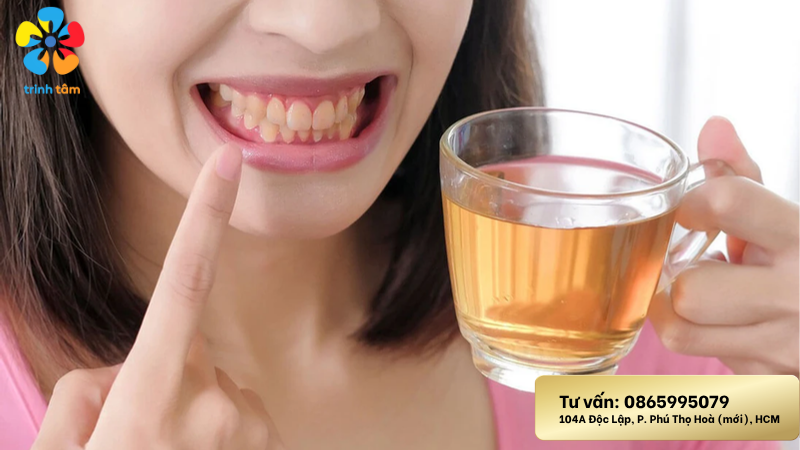 Bọc răng sứ có tẩy trắng được không? | Bọc sứ giá rẻ