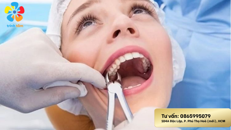 Nhổ răng khôn nên kiêng ăn gì | Nhổ răng khôn giá rẻ