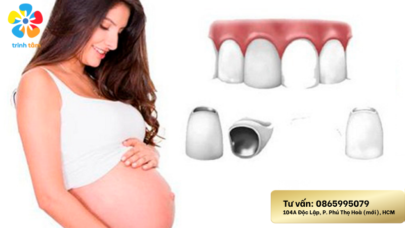 bọc răng sứ khi mang thai